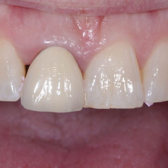 Tänder - Tandläkare Östermalm