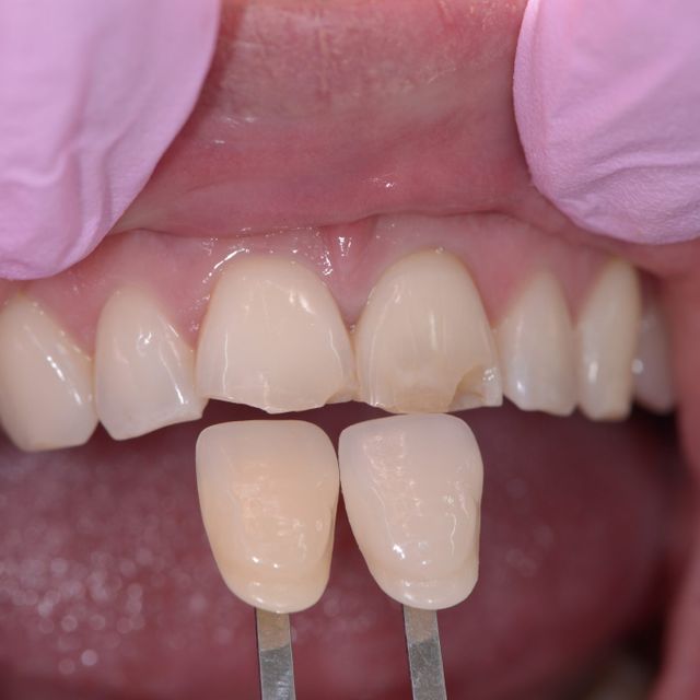 Tänder - Tandläkare Östermalm